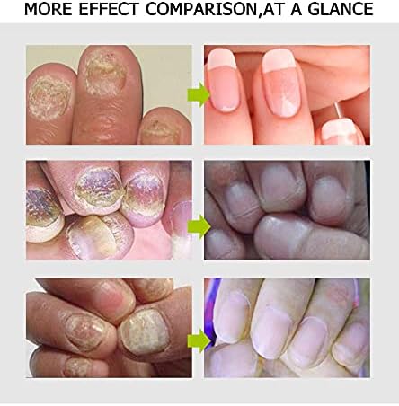 Efero-Crème réparatrice pour ongles